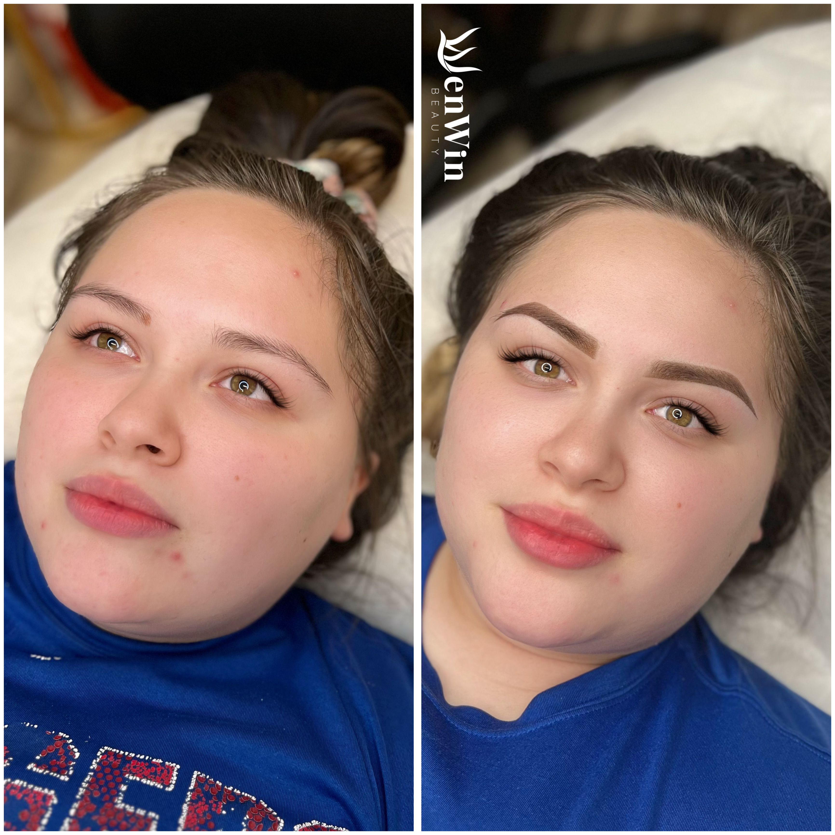 Before and after
