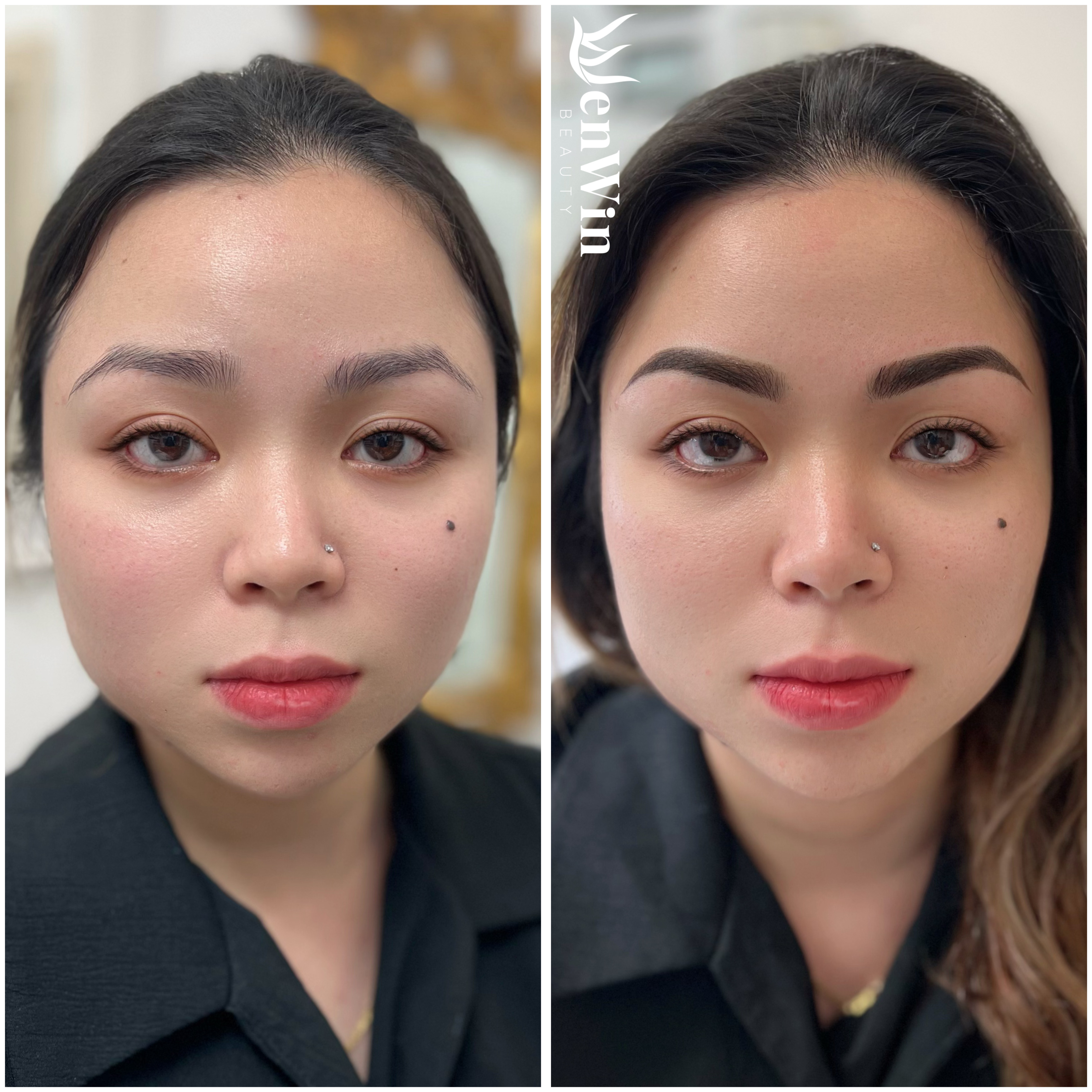 Before and after