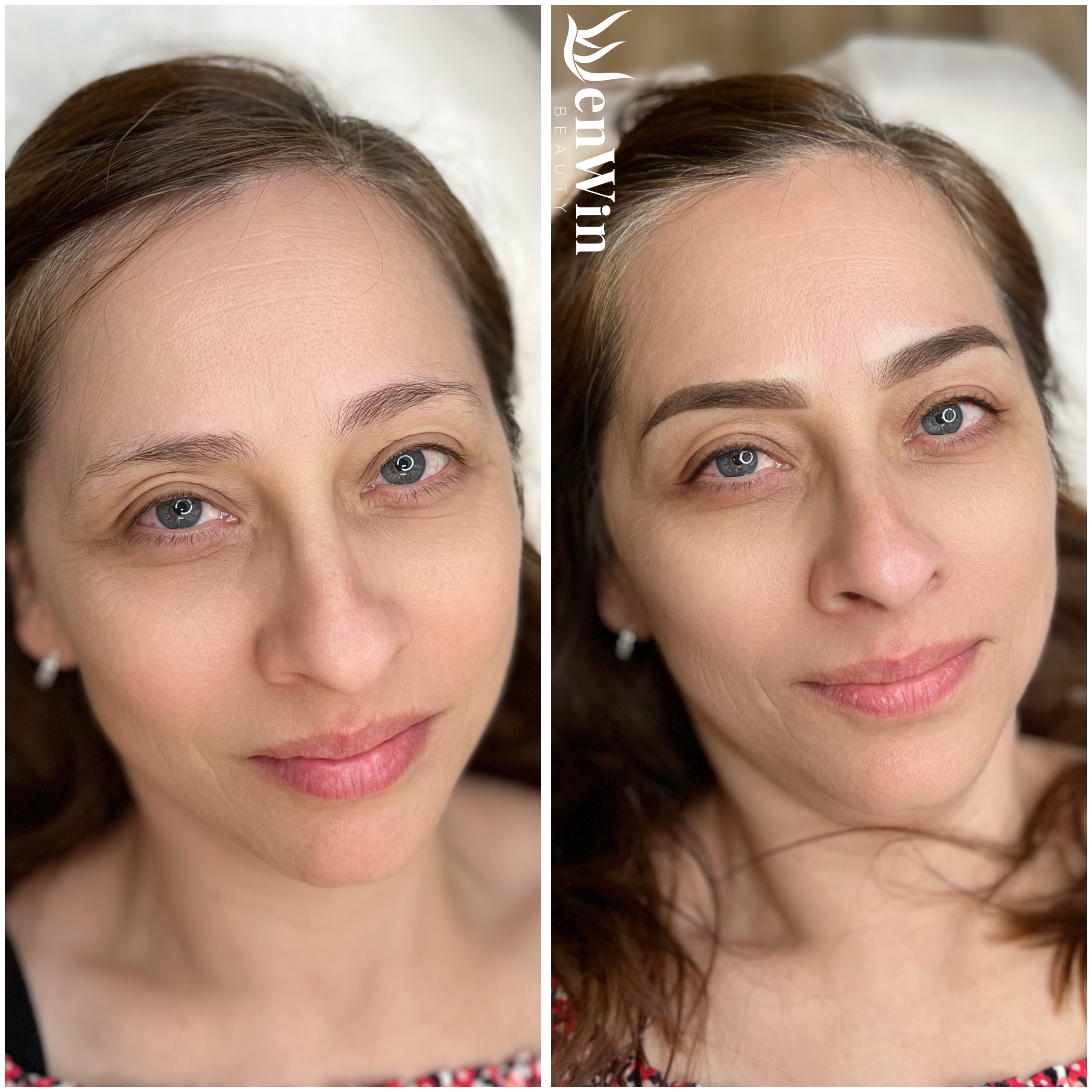 Before and after