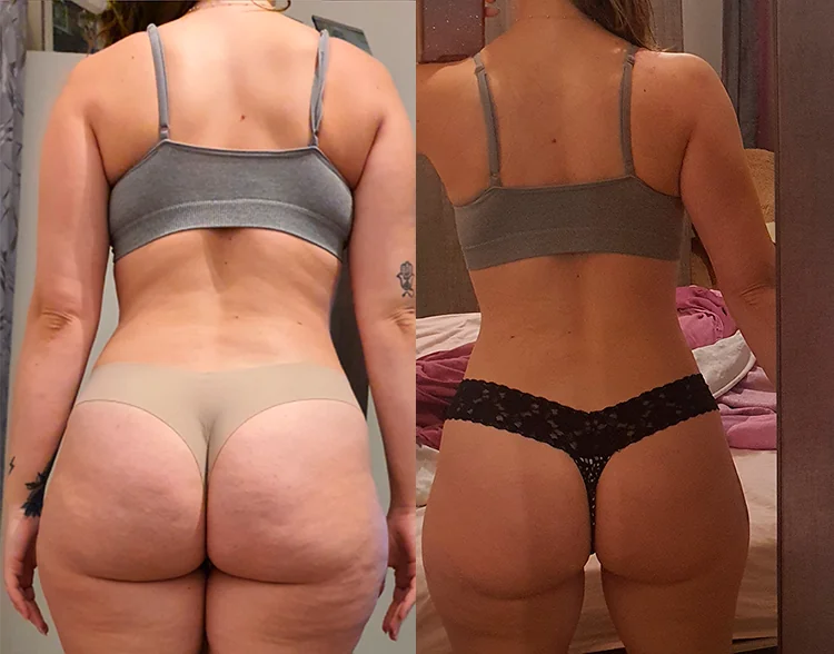 andrea-perez-antes-despues