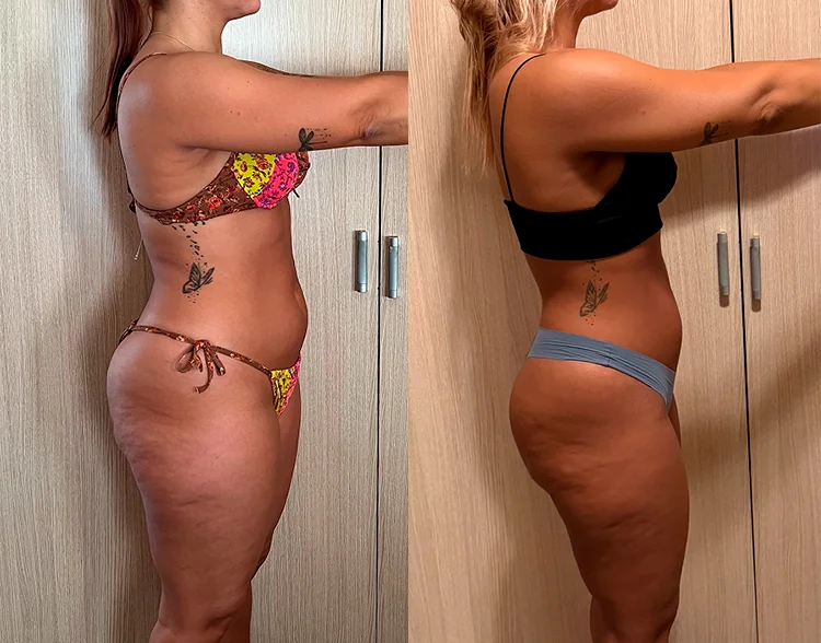 inma-antes-despues