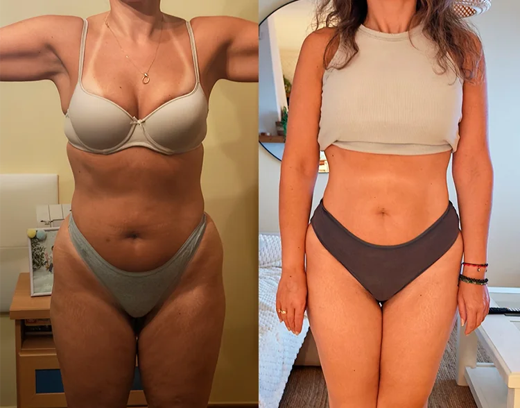 noelia-antes-despues