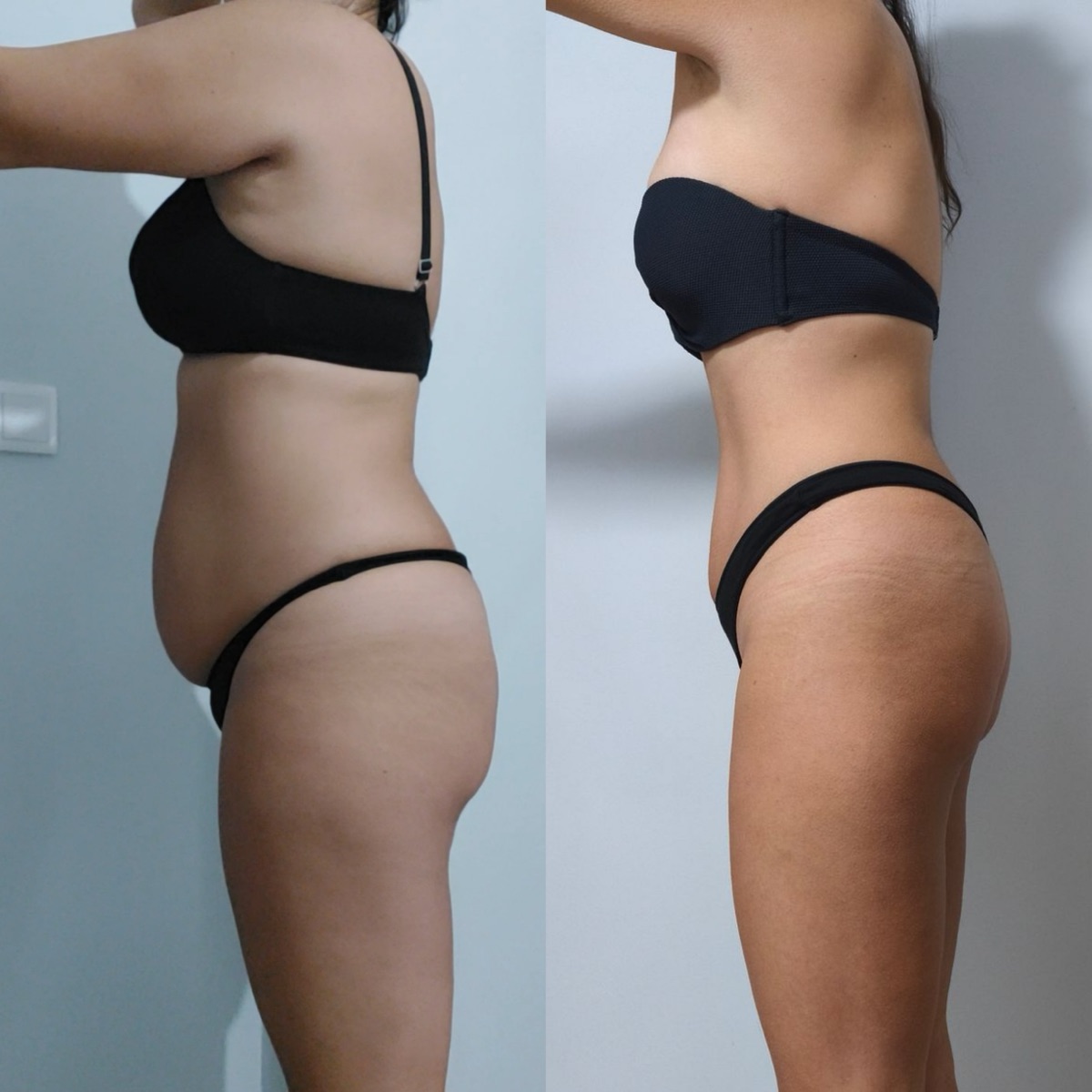 Antes y después de una clienta de ONFIT (3 de 15)
