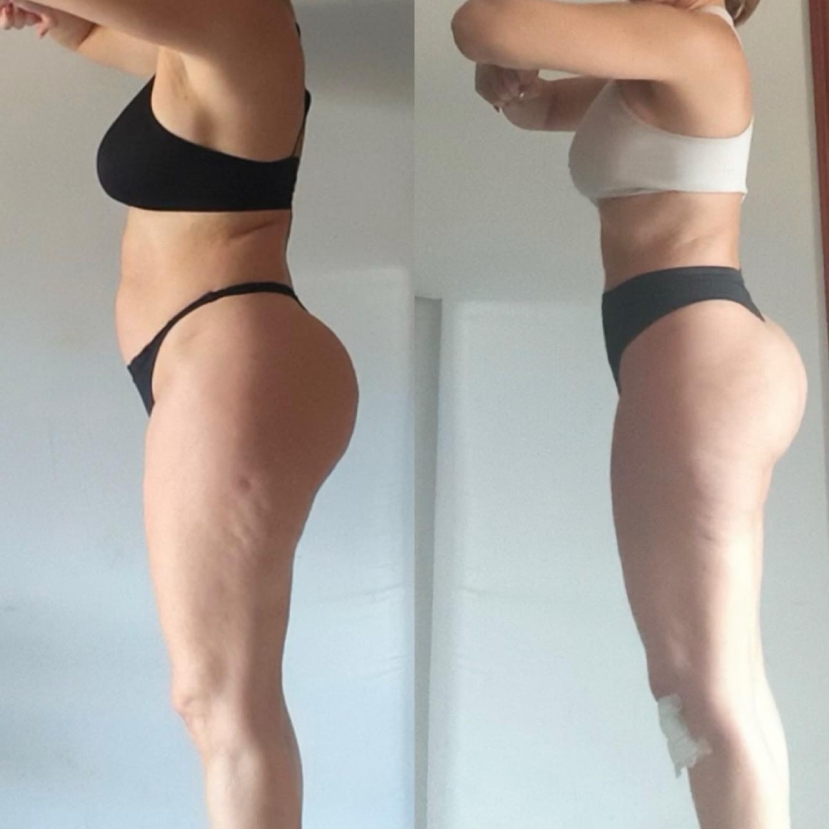 Antes y después de una clienta de ONFIT (4 de 15)