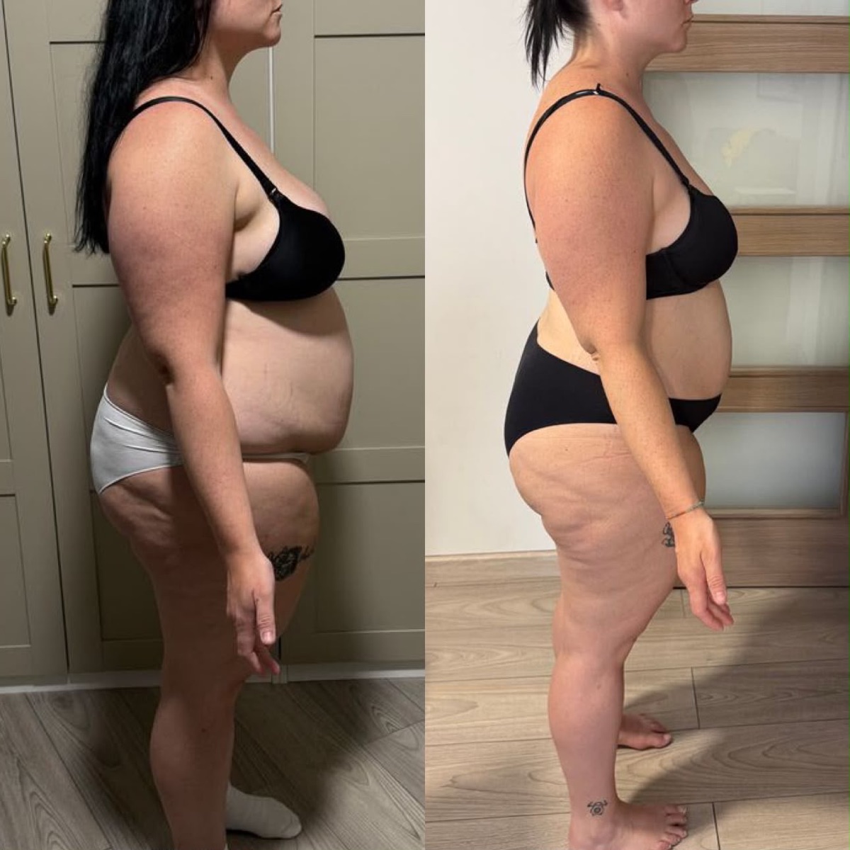 Antes y después de una clienta de ONFIT (6 de 15)