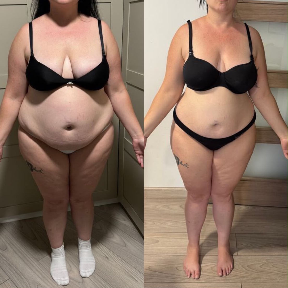 Antes y después de una clienta de ONFIT (7 de 15)