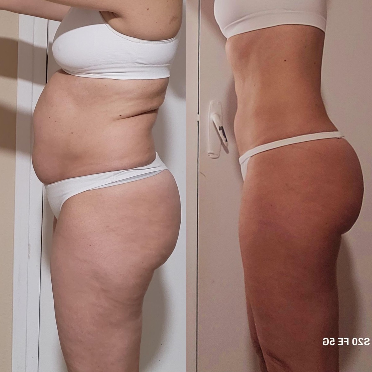 Antes y después de una clienta de ONFIT (11 de 15)