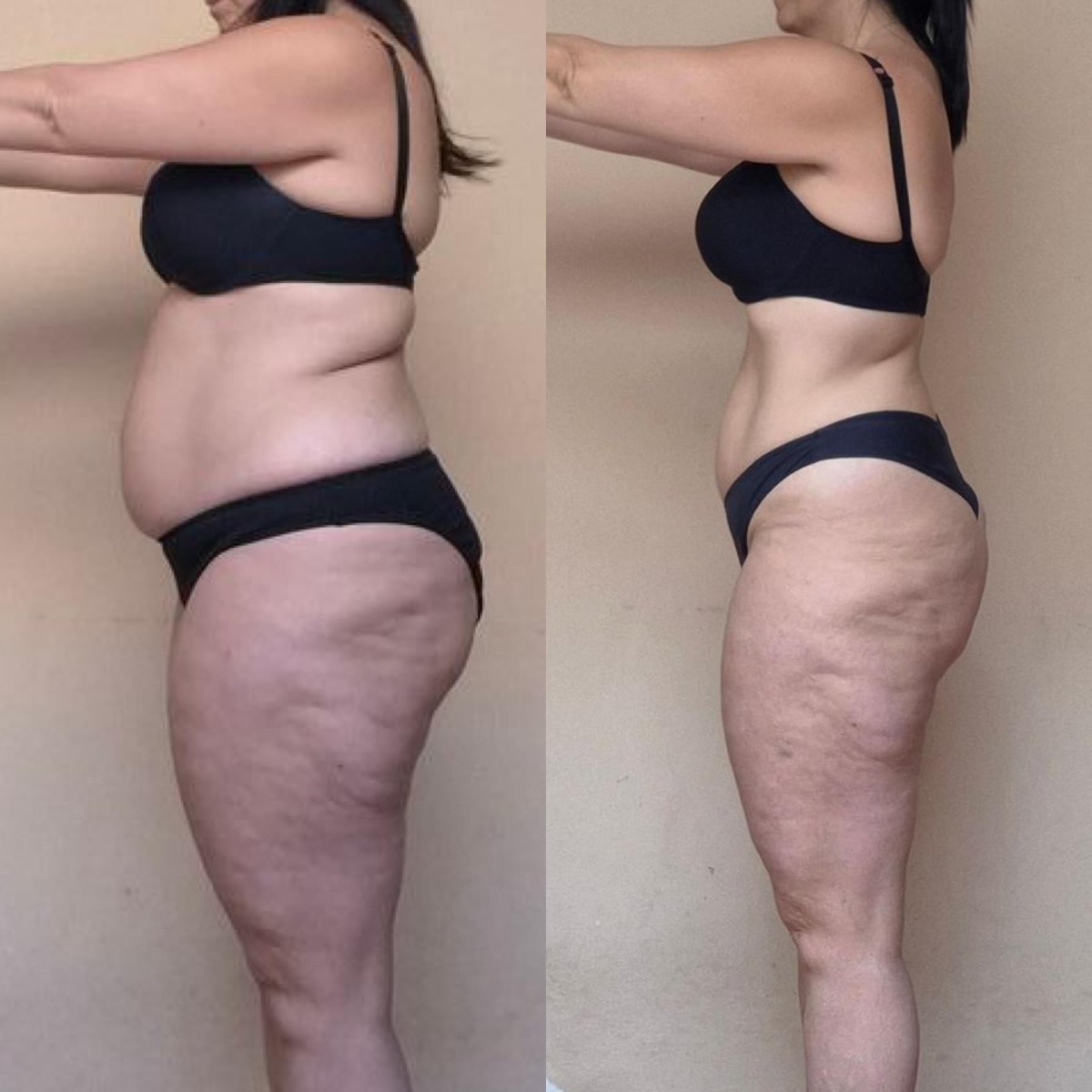 Antes y después de una clienta de ONFIT (12 de 15)