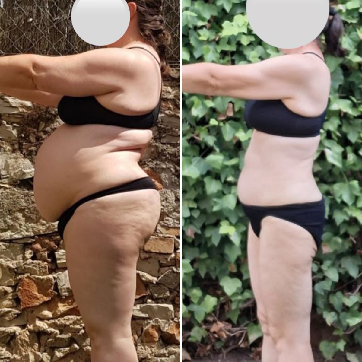 Antes y después de una clienta de ONFIT (14 de 15)