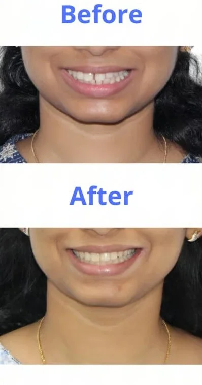 Patient smile transformation 7