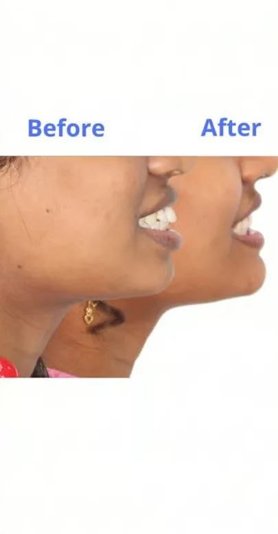 Patient smile transformation 6