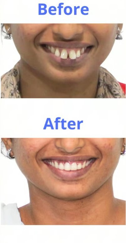 Patient smile transformation 8