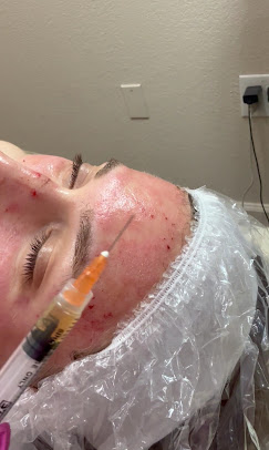 Precision treatment at GlowBar Oviedo