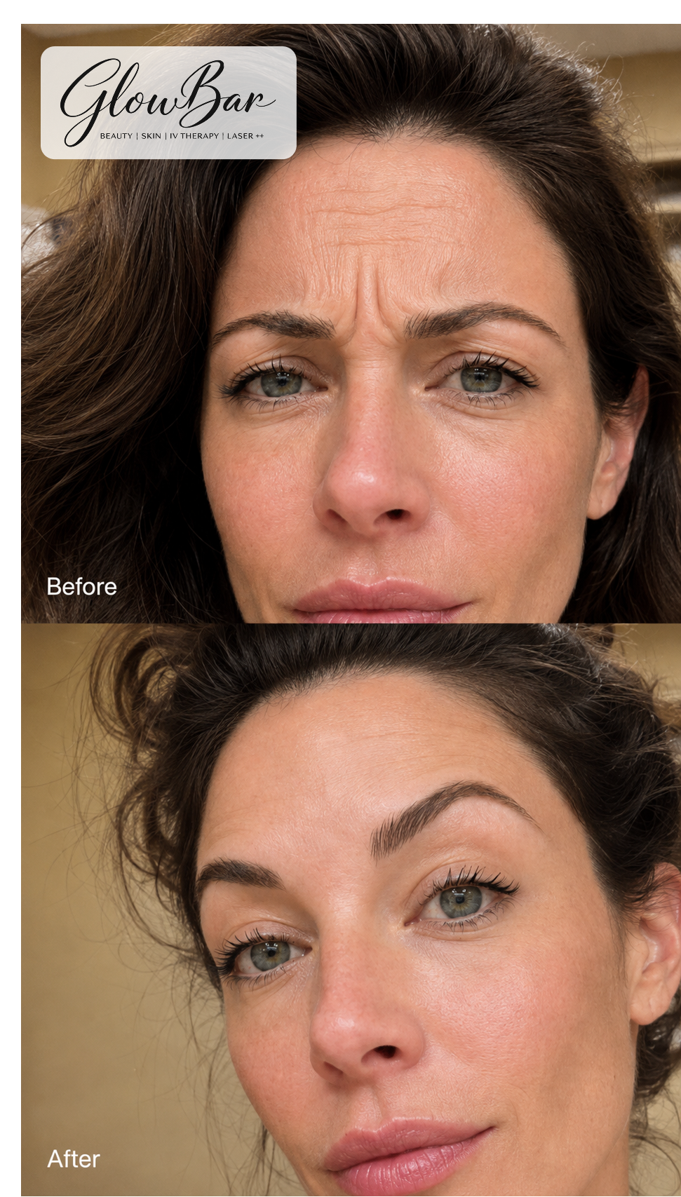 GlowBar before and after treatment comparison 6