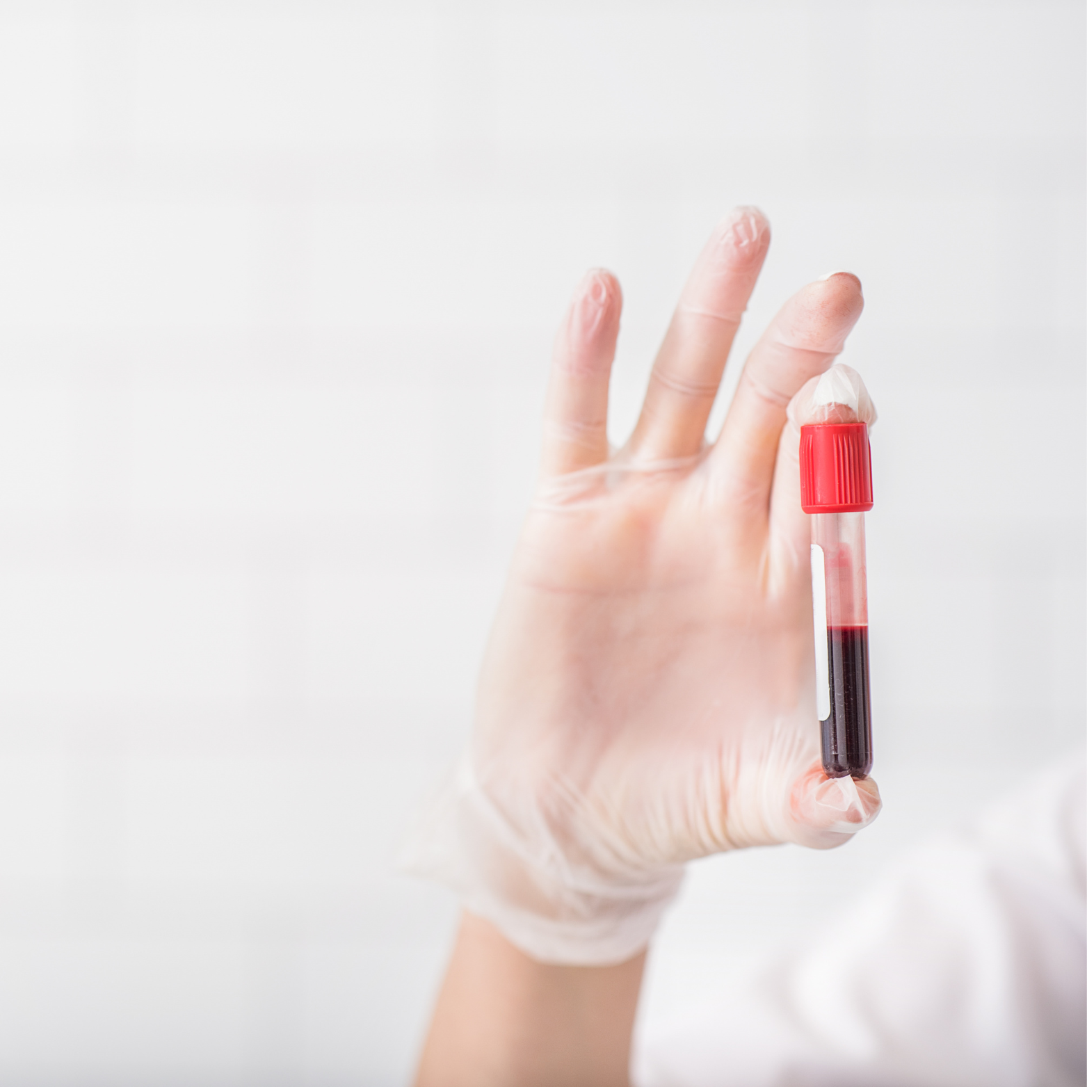 Vitamin D injection discussion after a private blood test at Shamis Wellness