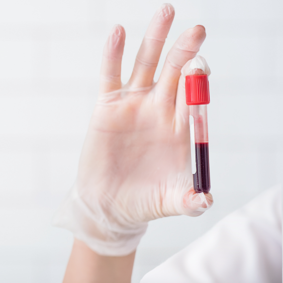 Private blood test appointment at Shamis Health & Beauty clinic on Hertford Road, Enfield Private blood test appointment at Shamis Health & Beauty clinic on Hertford Road, Enfield