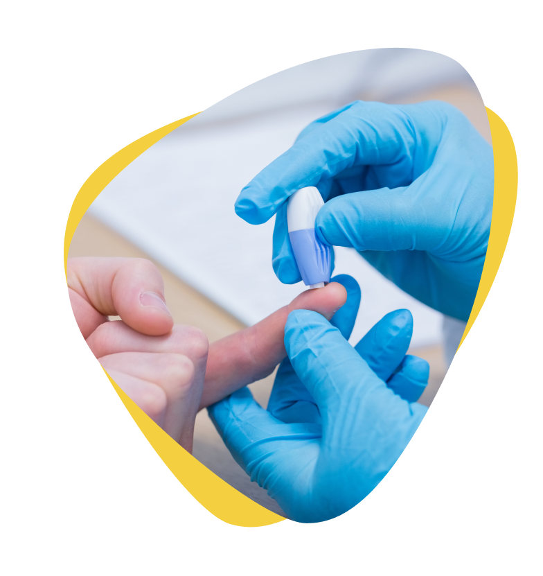 Private TSH thyroid blood test in Enfield Private TSH thyroid blood test in Enfield