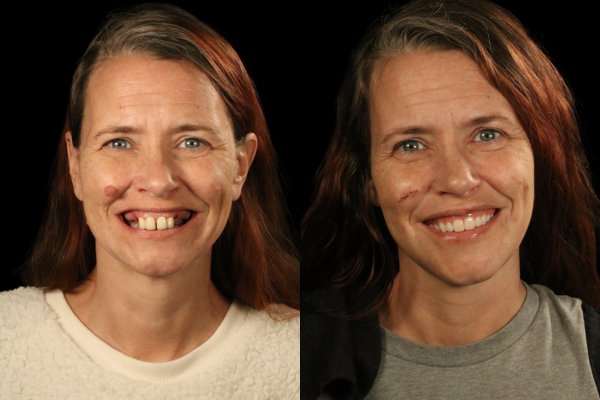 Angela, dental implant patient at Just Wright Dental in Corsicana TX