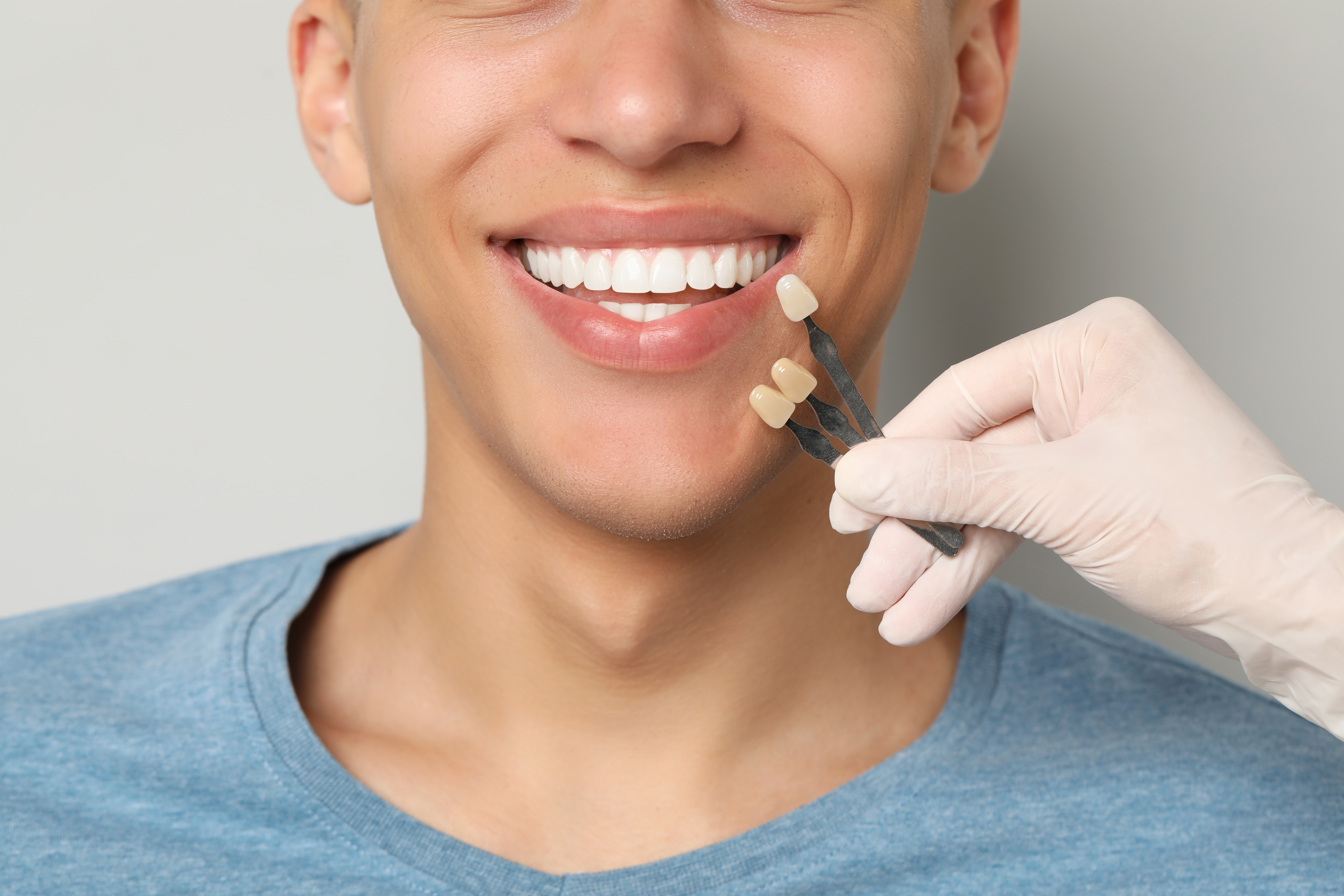 Porcelain veneers smile makeover results at Just Wright Dental in Corsicana TX