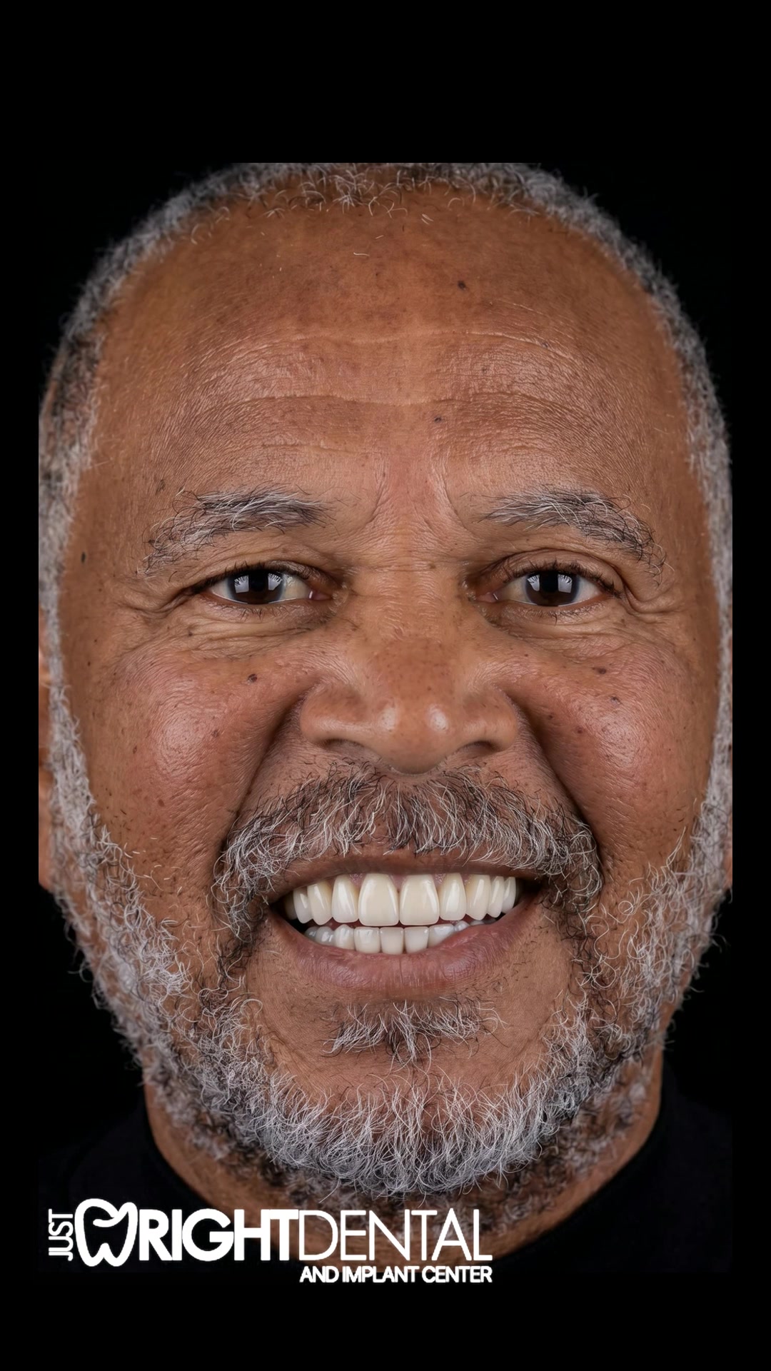 Smile transformation