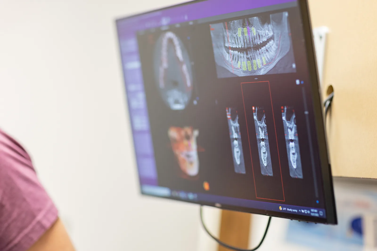 Digital smile design and implant planning software on screen at Just Wright Dental in Corsicana, TX Digital smile design and implant planning software on screen at Just Wright Dental in Corsicana, TX