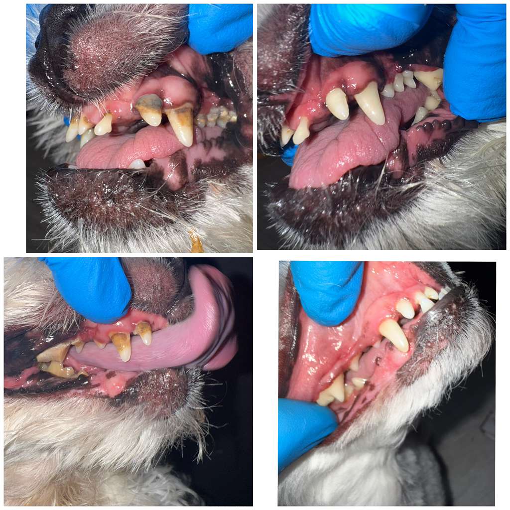 Real before/after dental cleaning work — tartar removal results