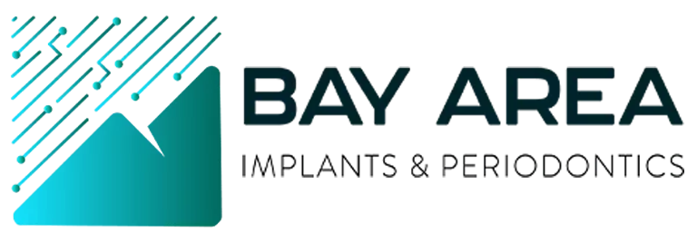 Bay Area Implants Perio