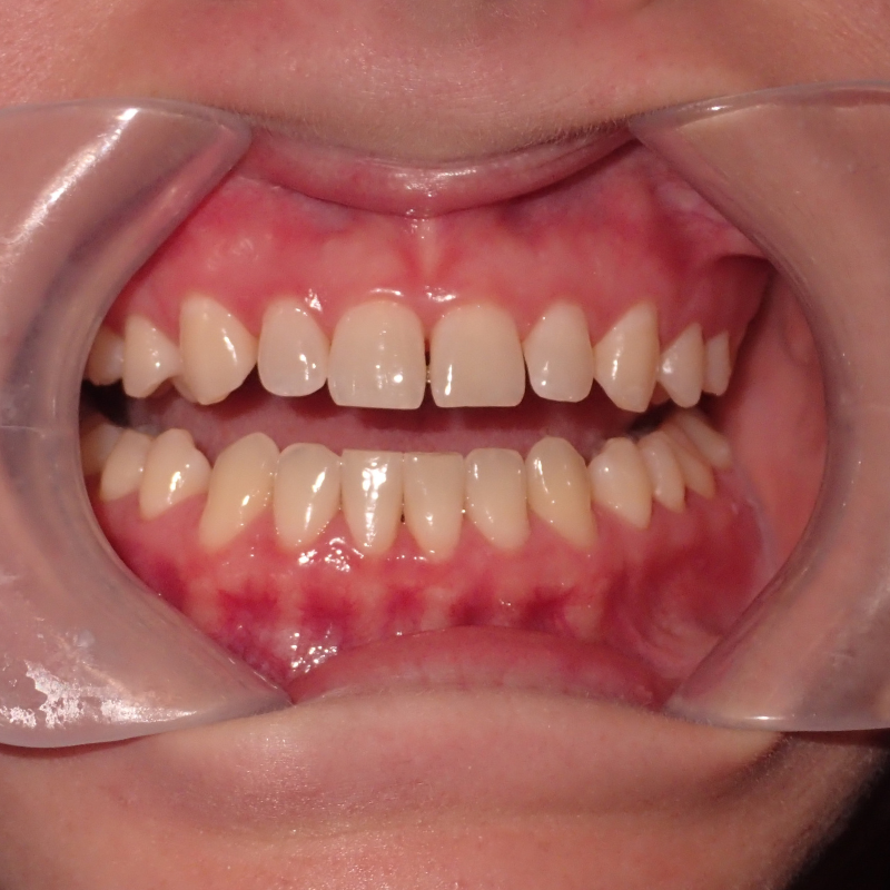 Before Image
