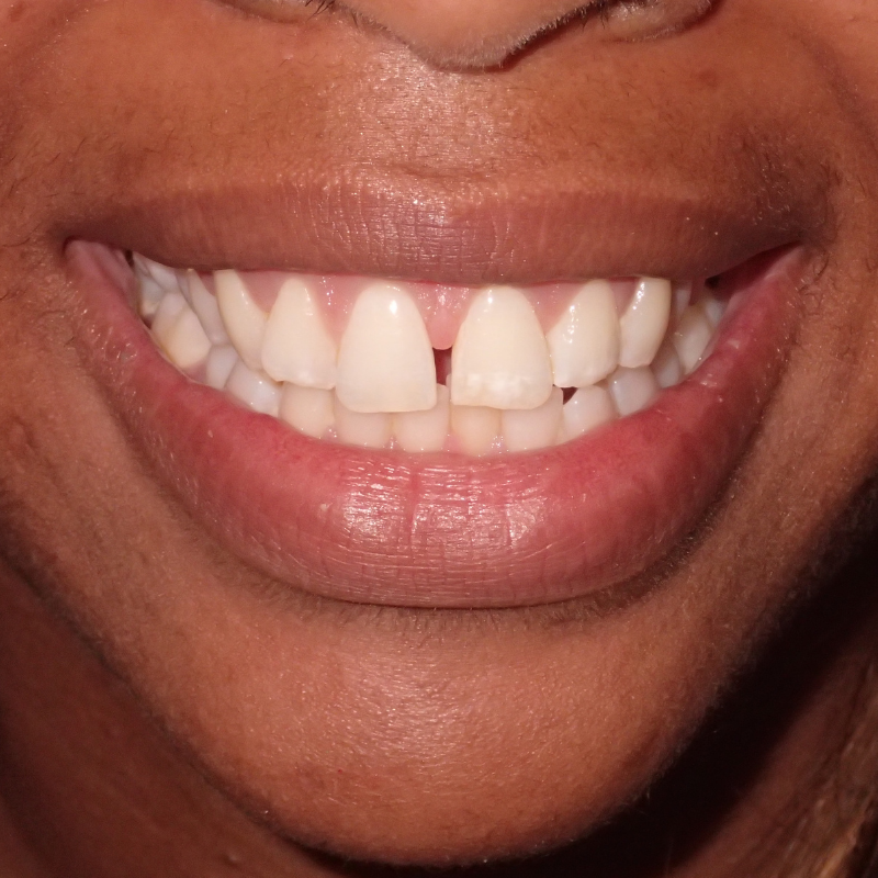 Before Image