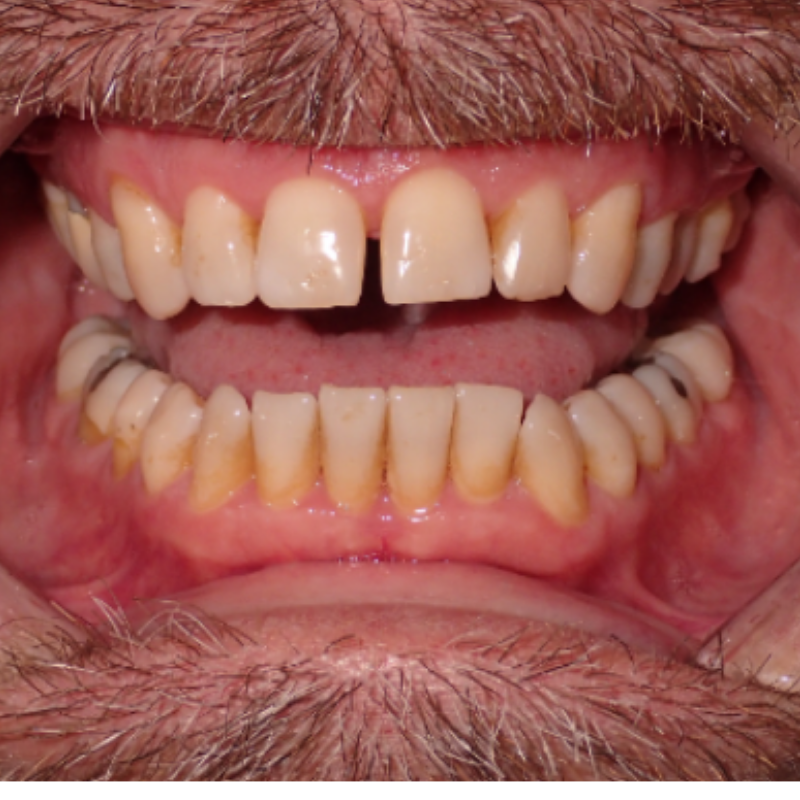 Before Image