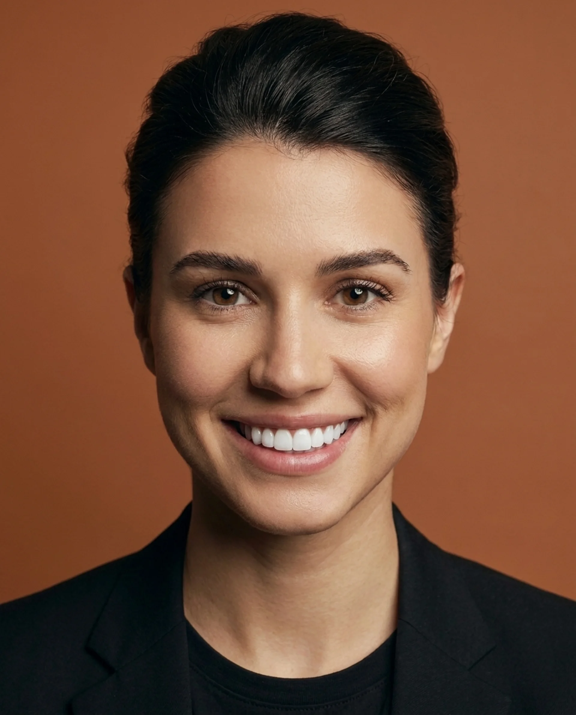 After smile transformation - The Smile Boutique