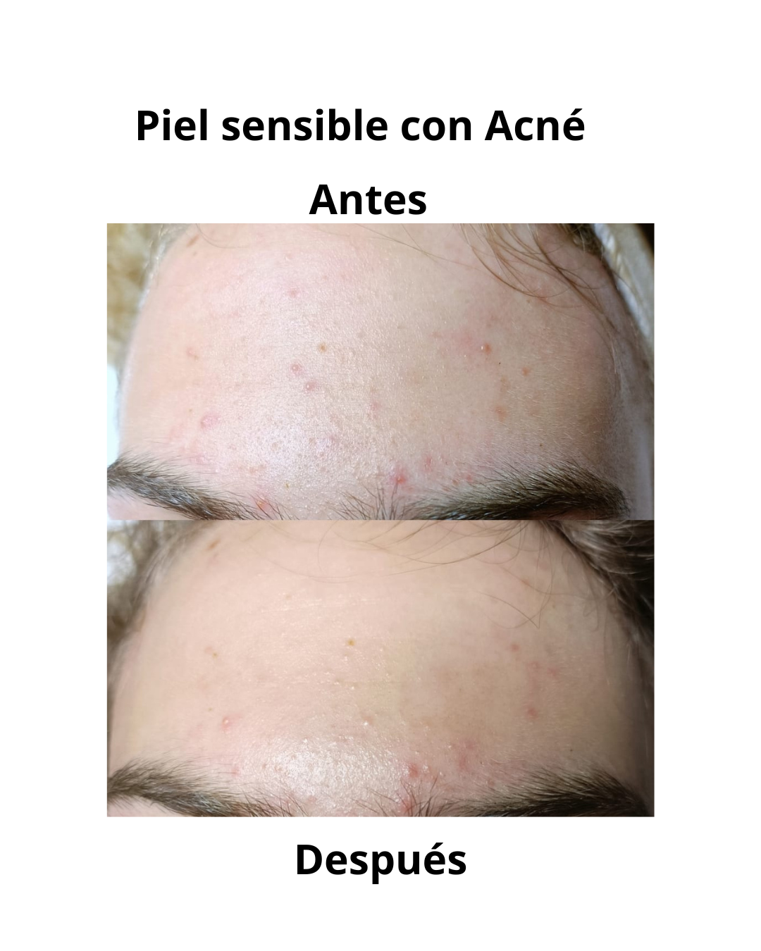 Resultado real
