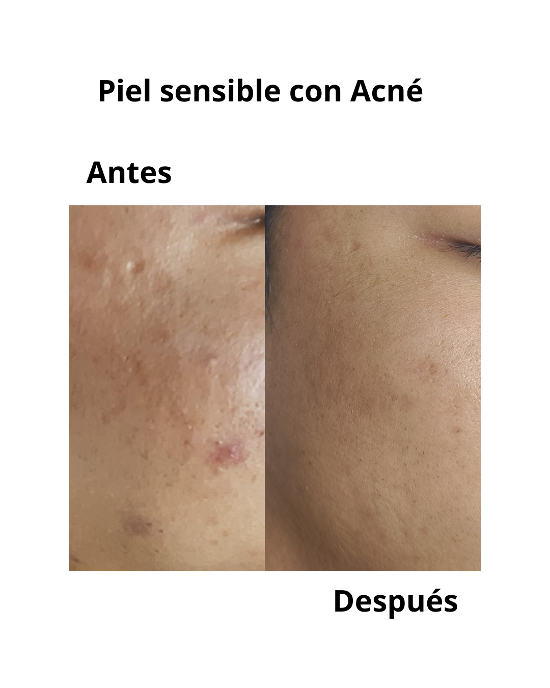 Resultado real