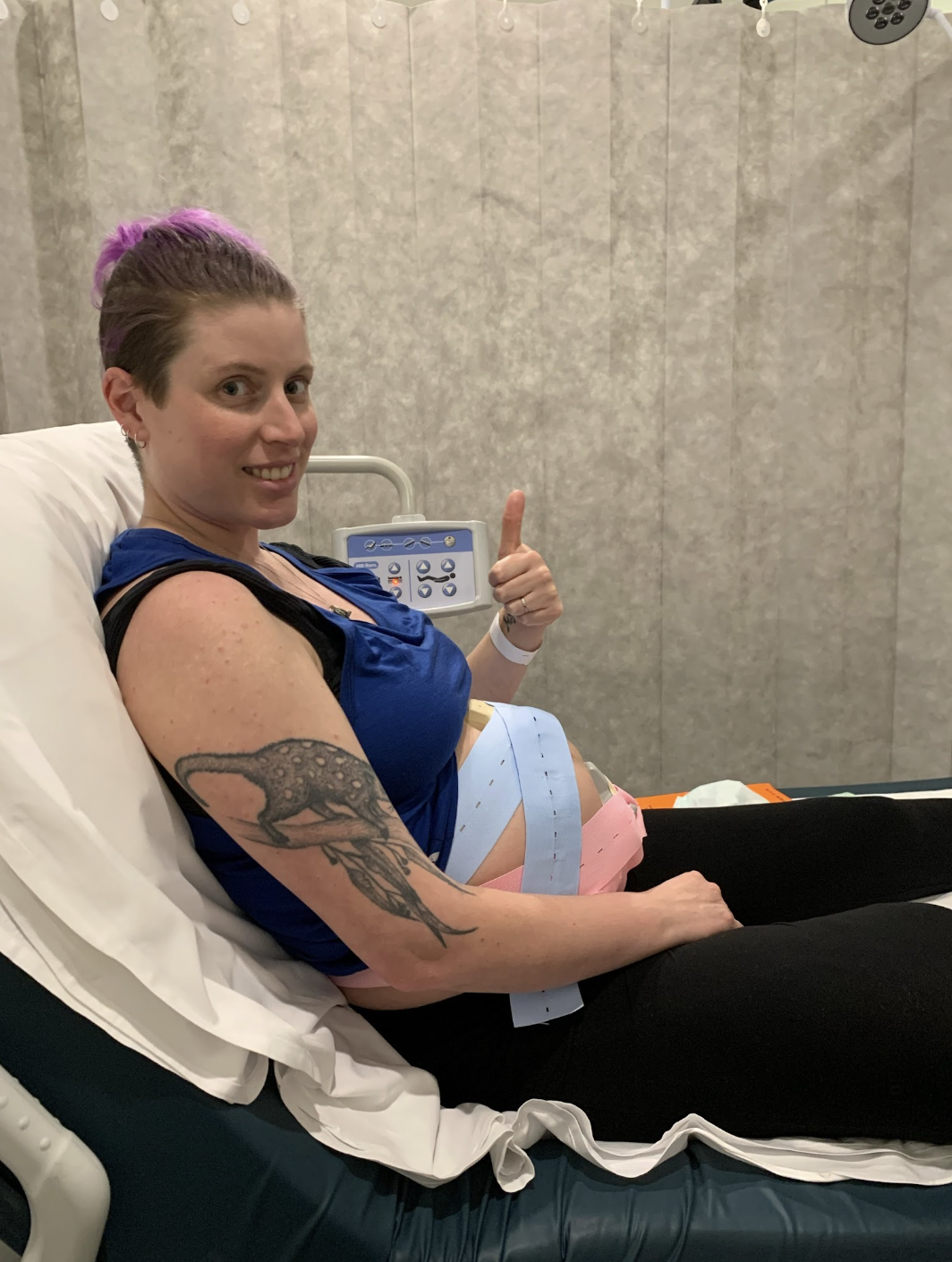 Image of person with purple hair and a blue tank top attached to a NST machine on a hospital bed. They are doing a thumbs up and have a concerned look on their face. Image of person with purple hair and a blue tank top attached to a NST machine on a hospital bed. They are doing a thumbs up and have a concerned look on their face.