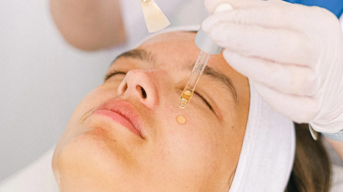 Chemical peel treatment