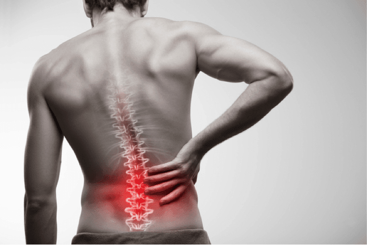 The Single Most Litigated Injury In Personal Injury Practice