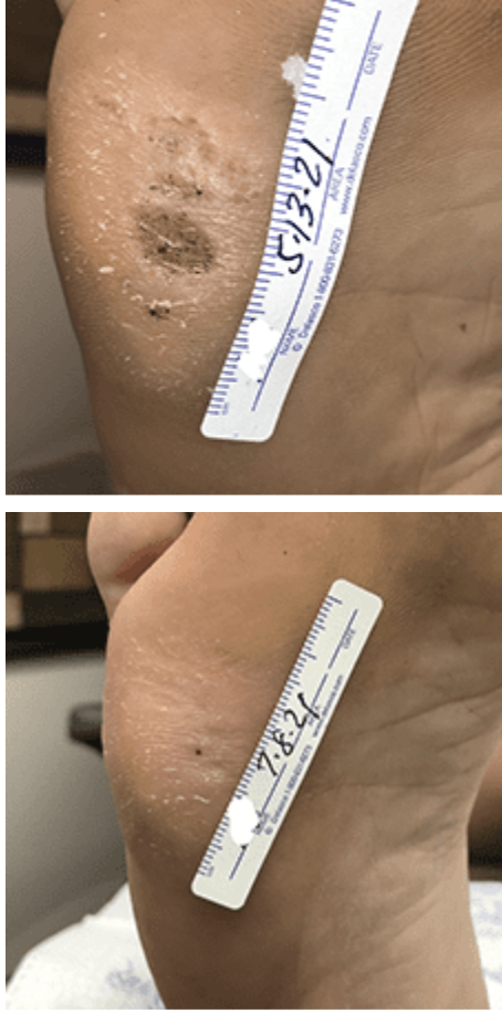 swift treatment pictures patient 1