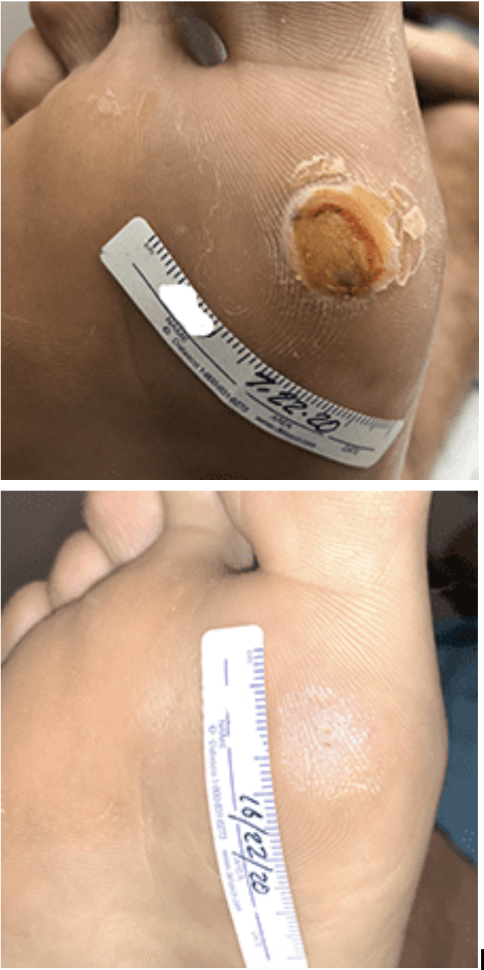 swift treatment pictures patient 2