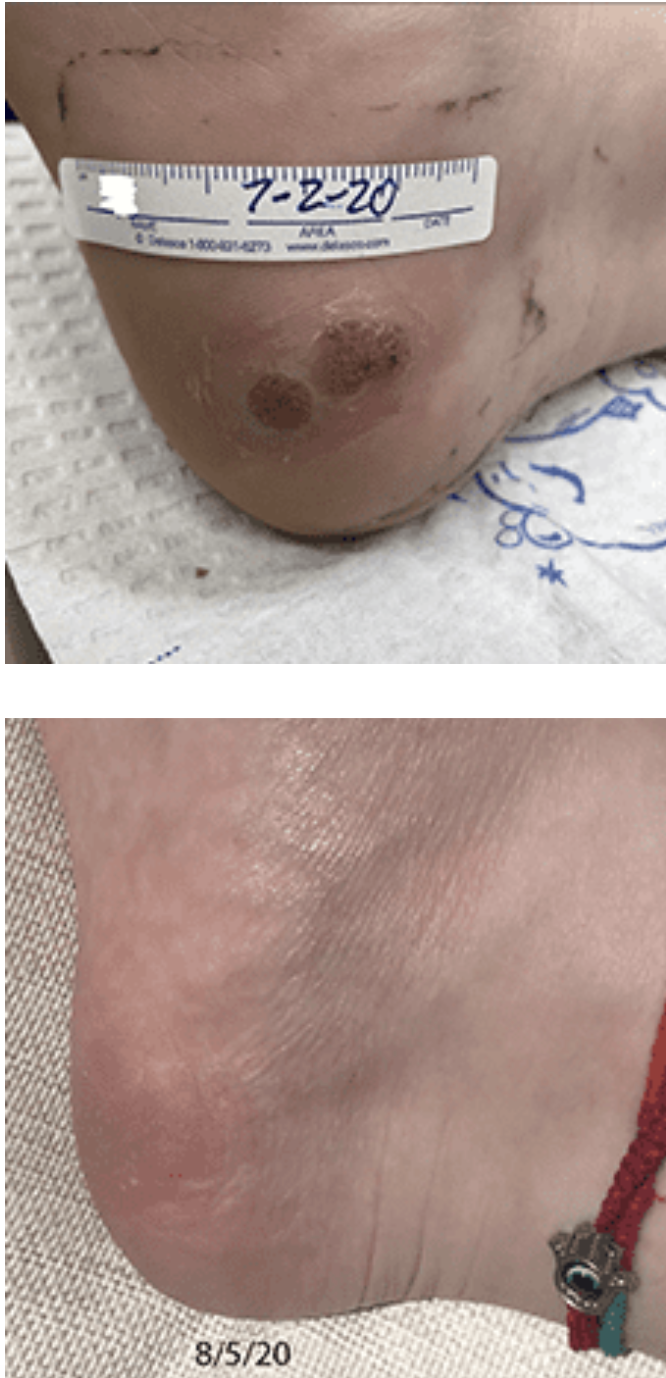 swift treatment pictures patient 5