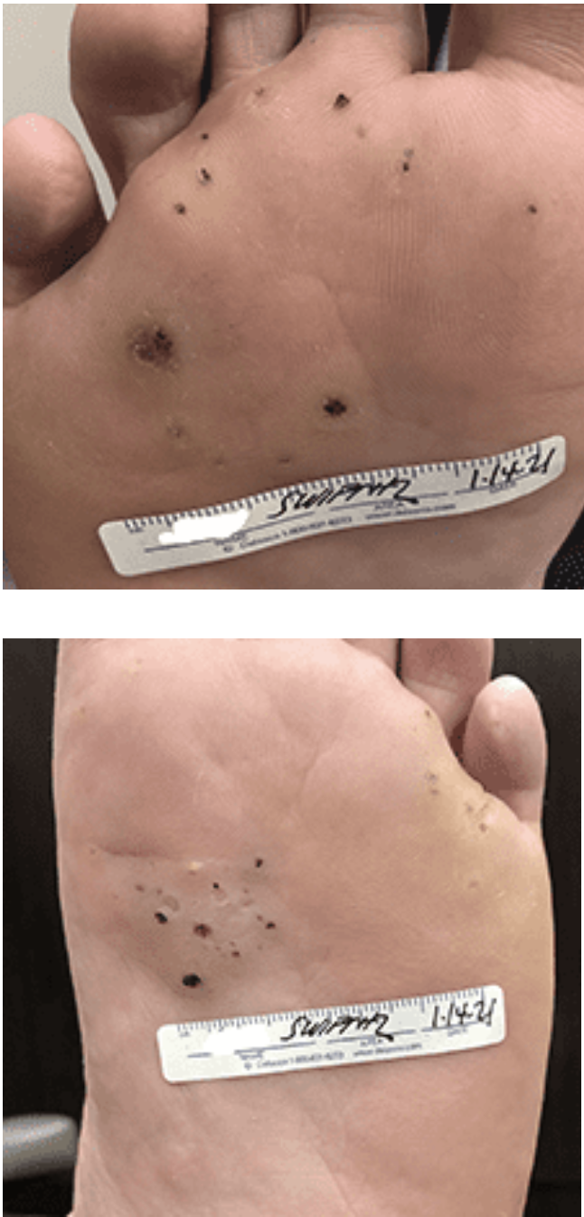 swift treatment pictures patient 6