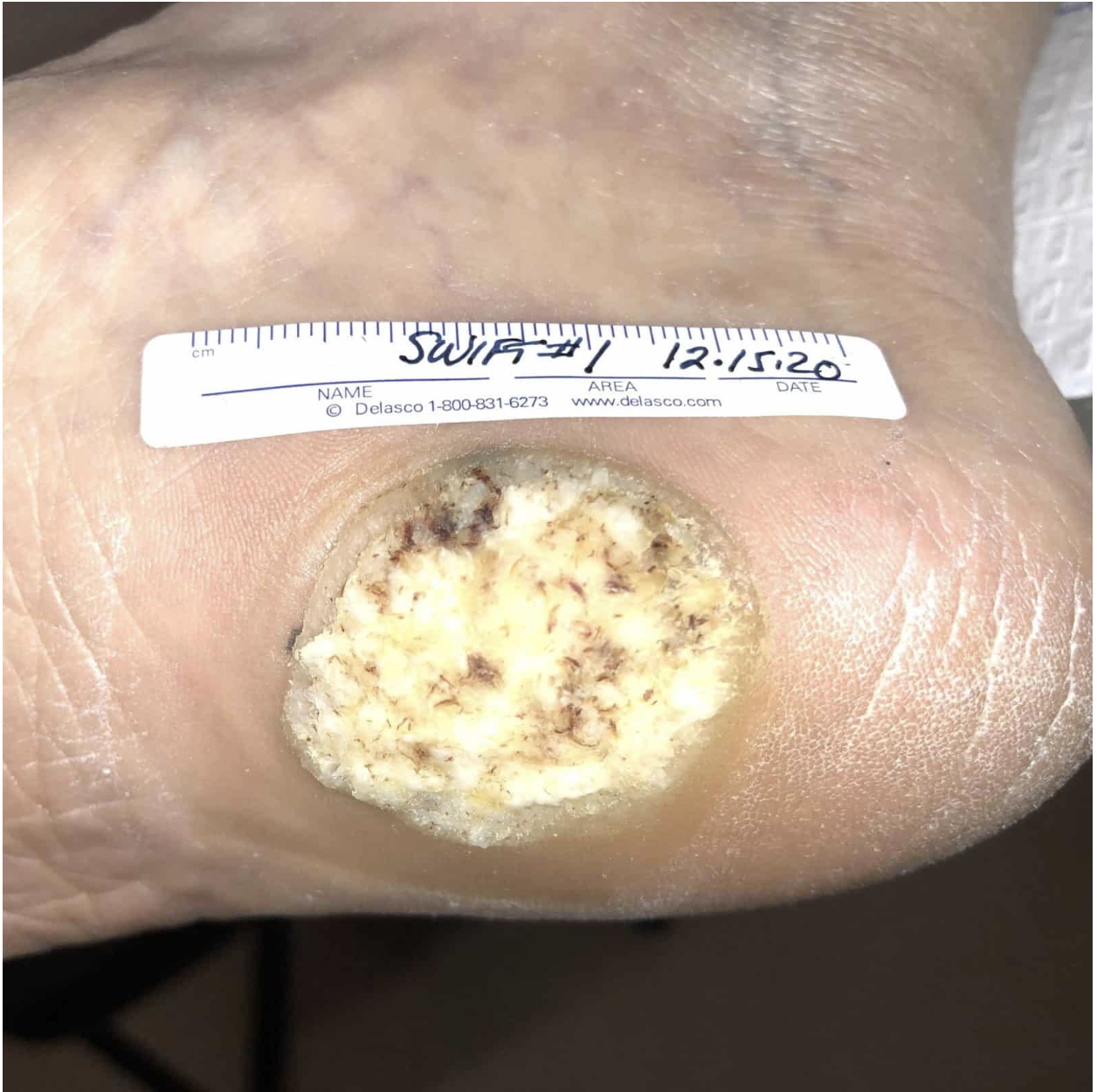 swift treatment pictures patient 7 before