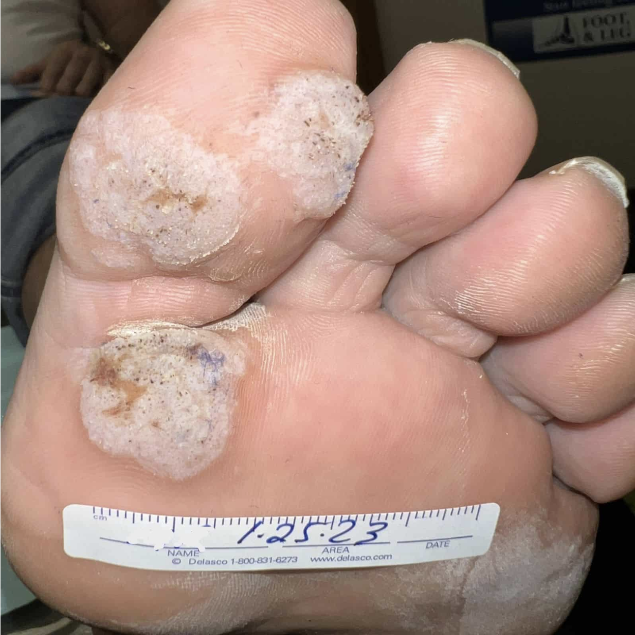 swift treatment pictures patient 8 before