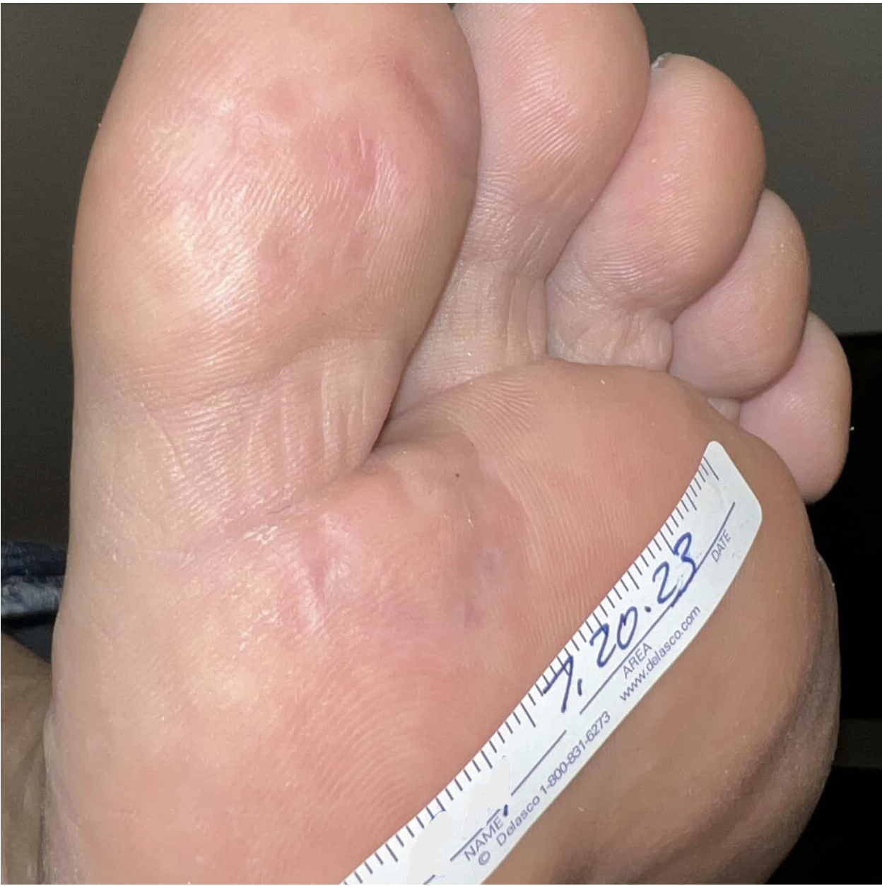 swift treatment pictures patient 8 after