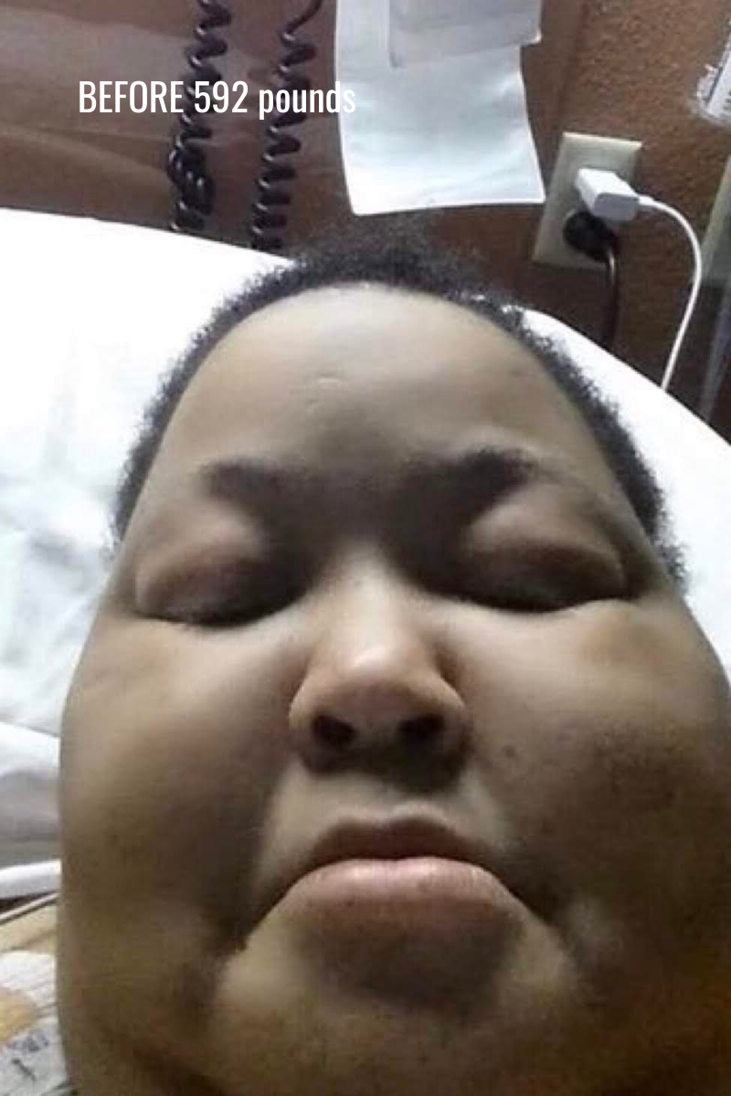 Kenya bedridden before her transformation, at 592 pounds