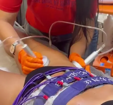 Electrostimulare pe abdomen în salonul Ramo Cosmetic House din Timișoara