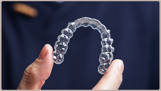 Clear Aligners