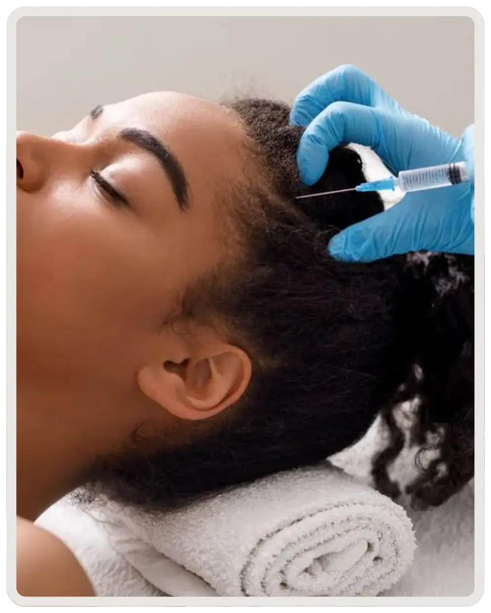 PRP Hair Restoration Treatments