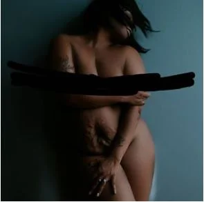 Black woman standing on dark wall showing stretch marks on her stomach.