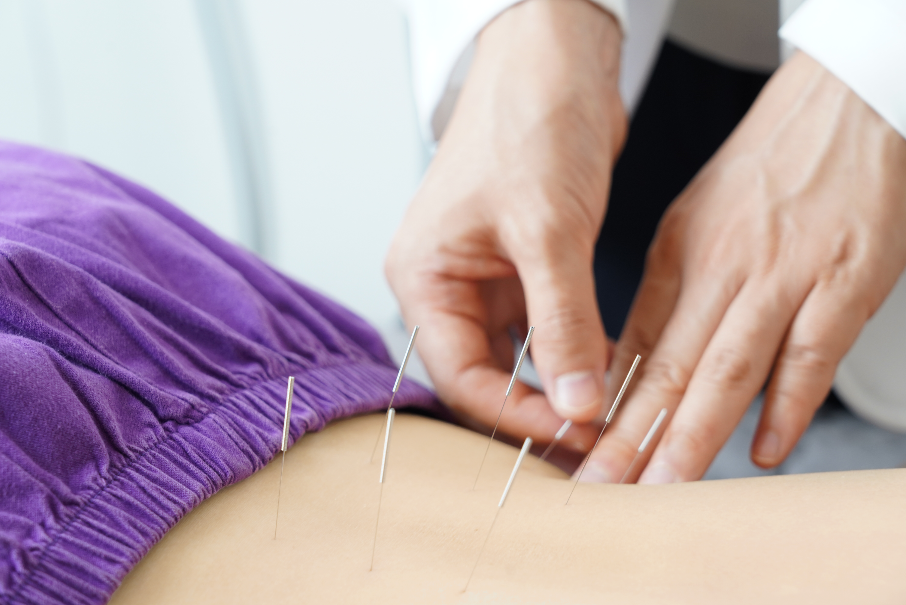 Acupuncture and Traditional Chinese Medicine