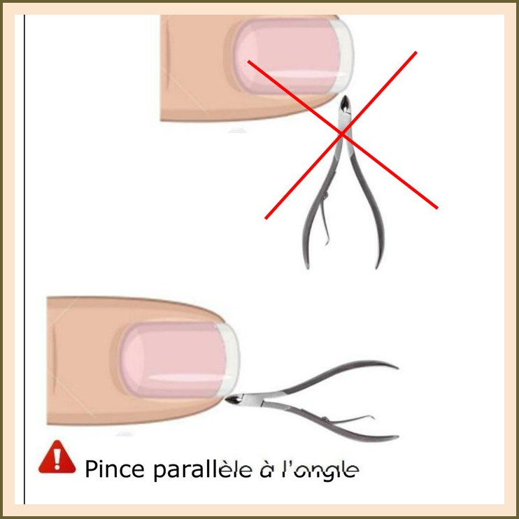 Les formes d'ongles